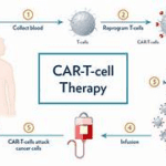 CAR-T cell therapy